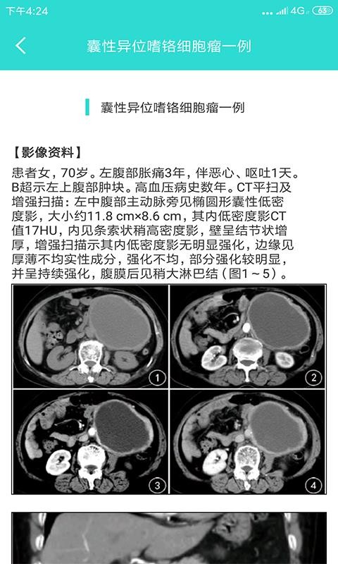 影像圖鑒截圖(4)